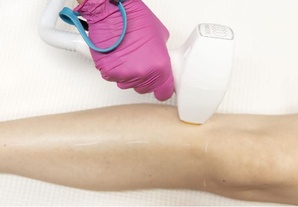 Traitement d'epilation.